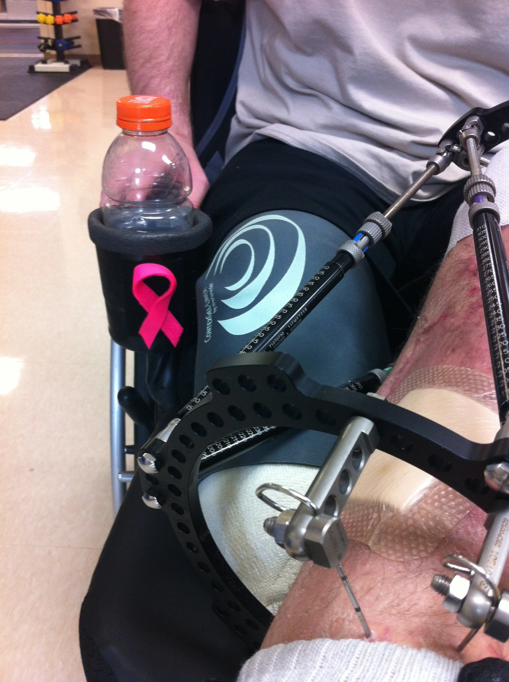 Splints-172.jpg