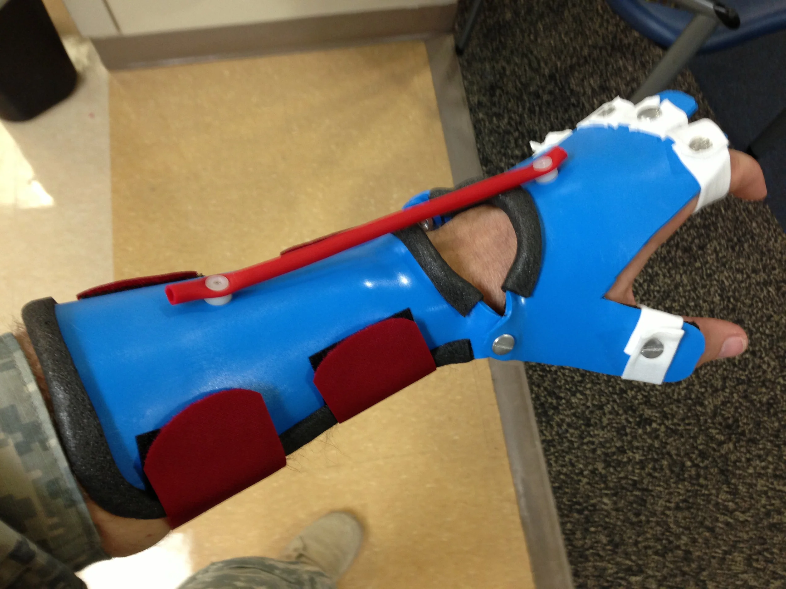 Splints-205.jpg