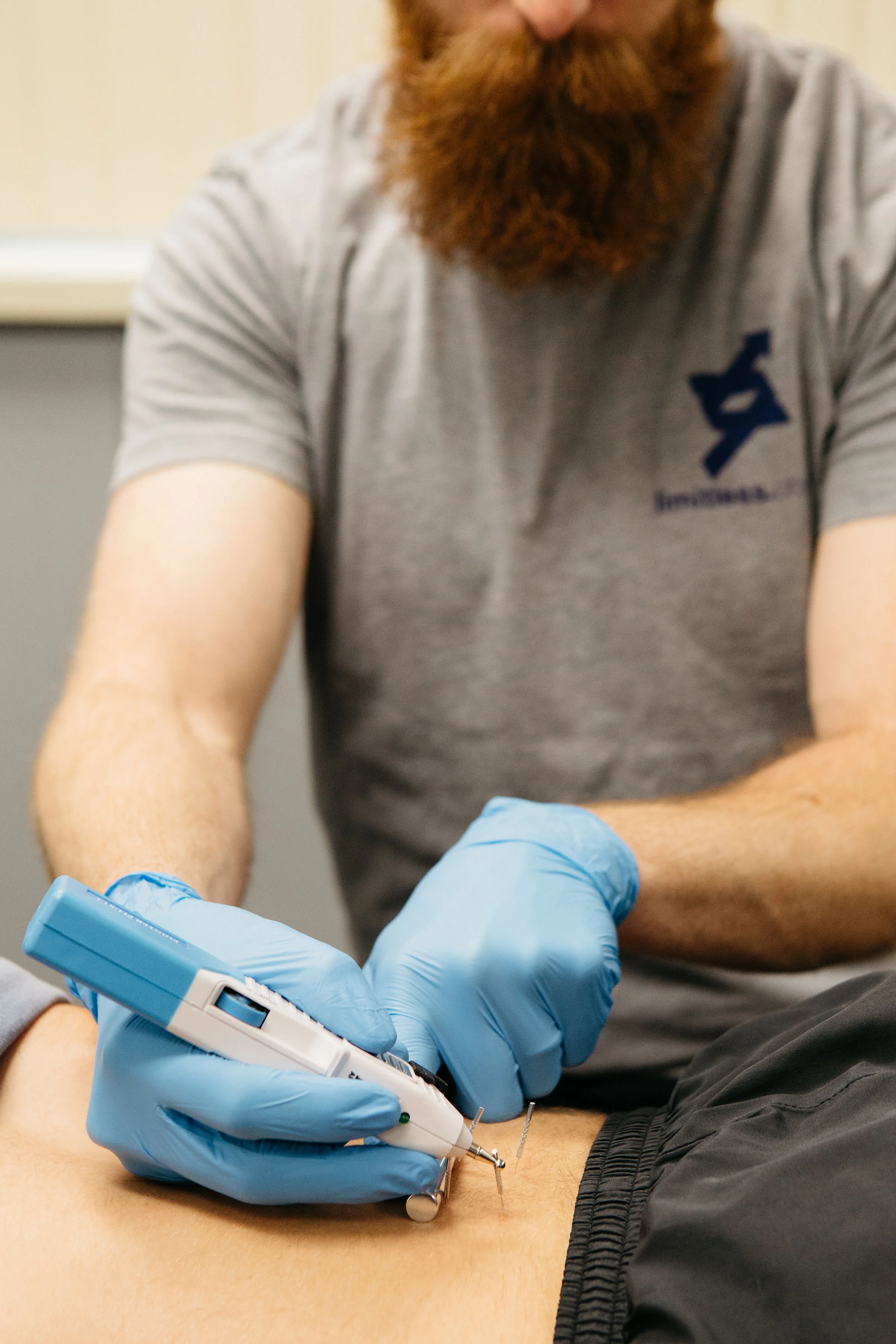 Dry Needling in Rochester Hills, MichiganLimitless Physical Therapy & Performance