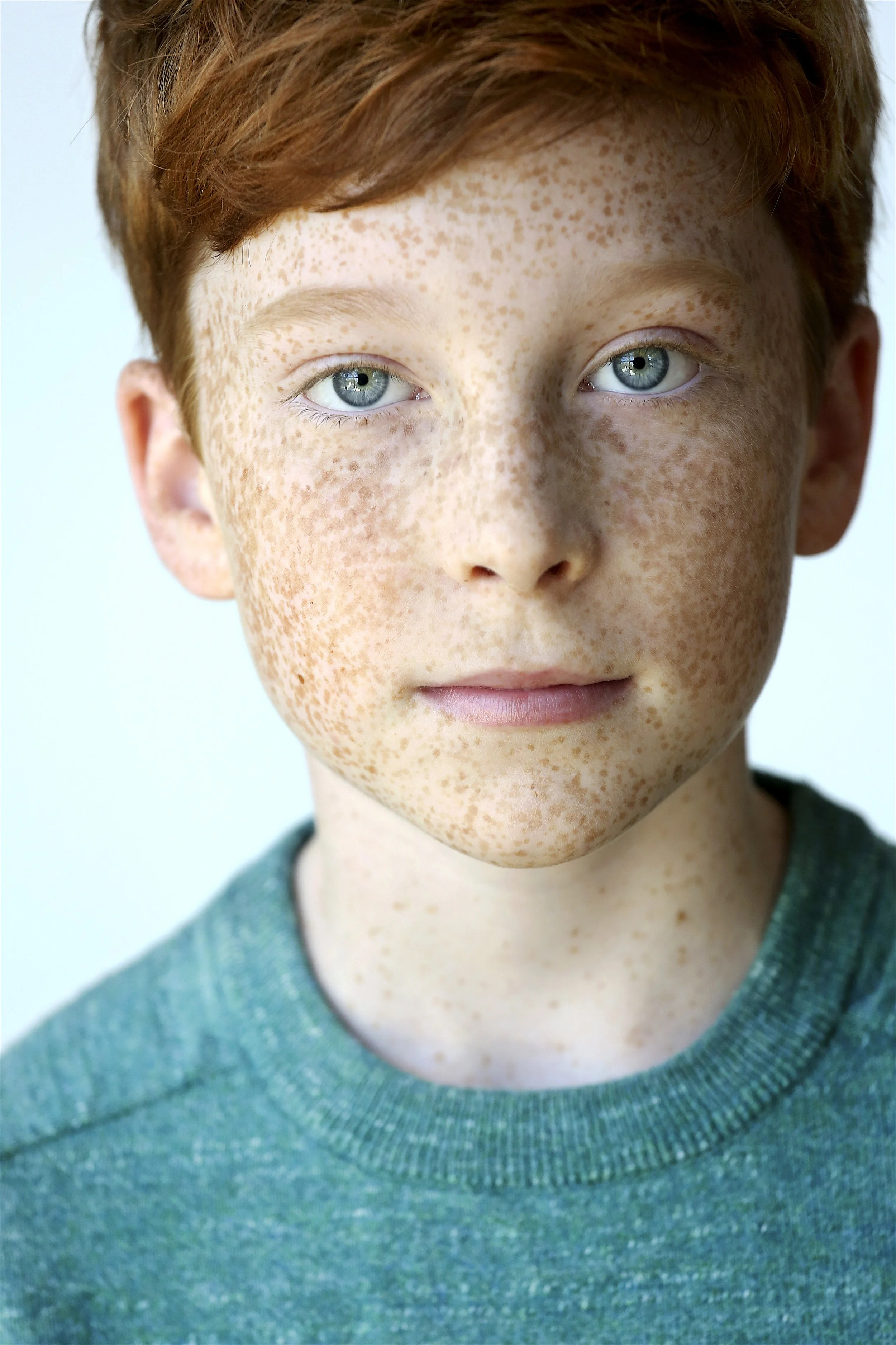 A young boy with red hair and blue eyes, covered in freckles, wearing a teal shirt.