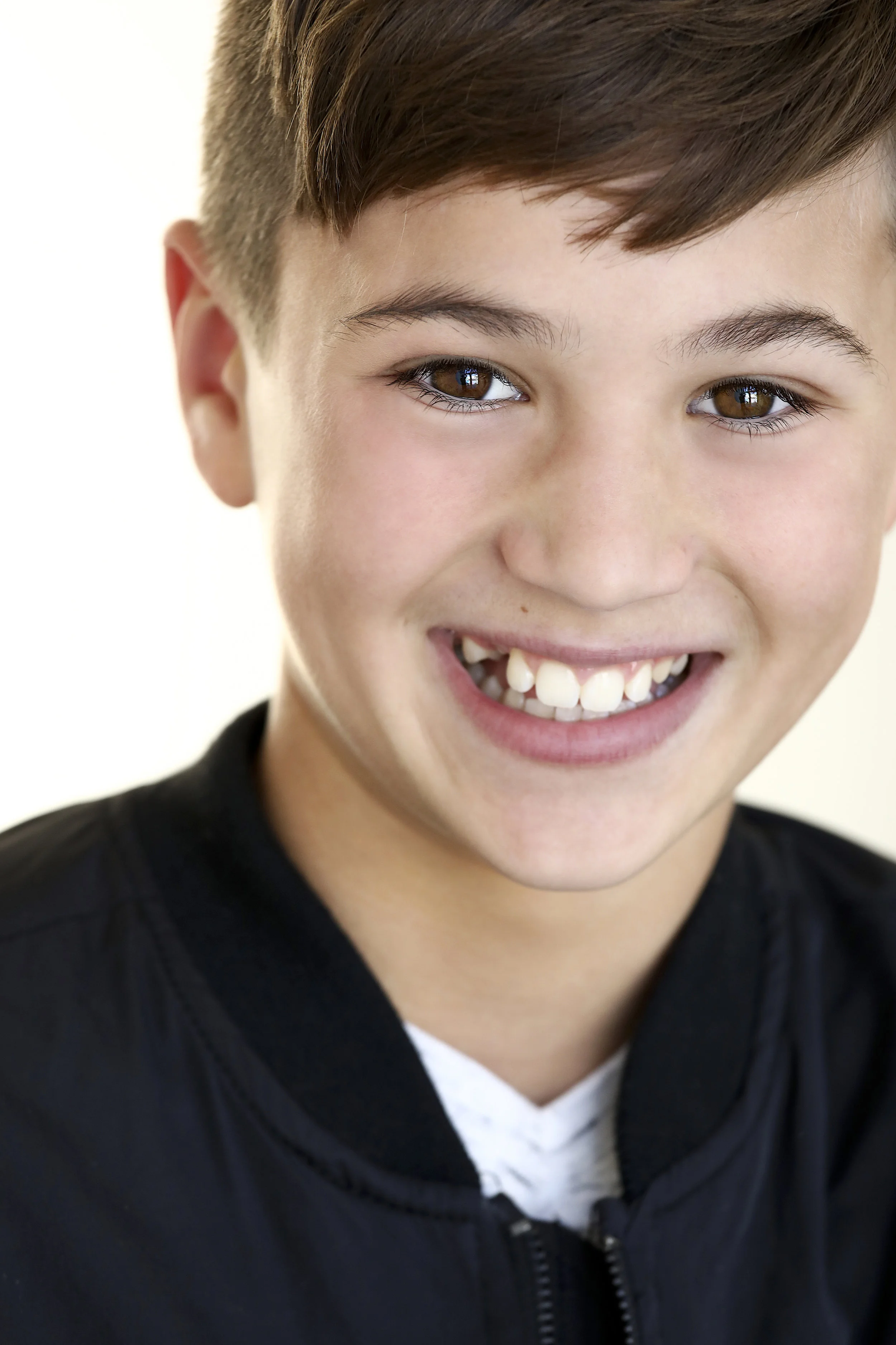 Close-up of a smiling boy with brown eyes, missing a front tooth, wearing a black jacket.