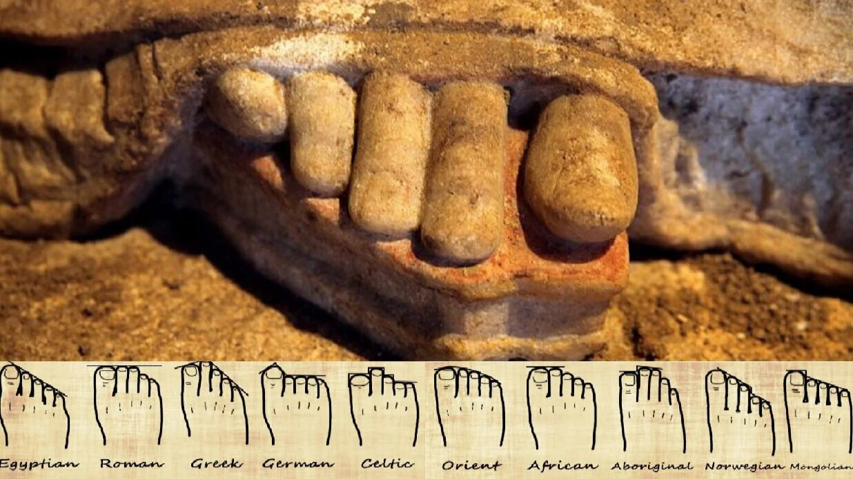 The "Greek toe" of the Caryatids: Can your feet reveal your Greek ancestry?