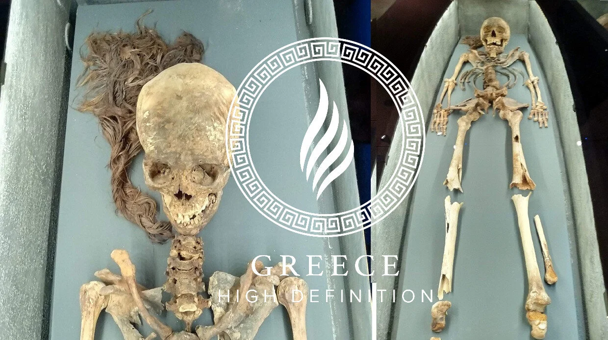 The dead with the unaltered ornamental plait: The rare find from Macedonia kept in the Archaeological Museum of Thessaloniki