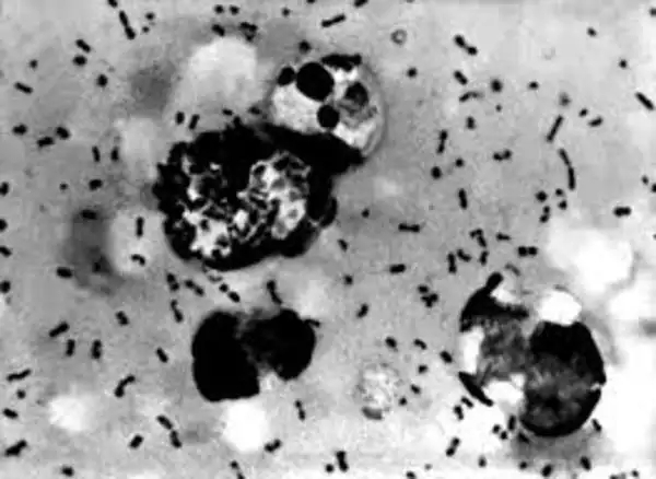 Bubonic plague under the microscope - BusinessInsider