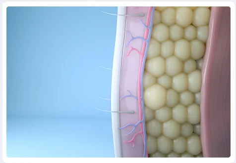 Fat Cells are Eliminated