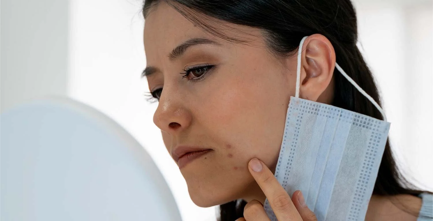 i need help with my skin