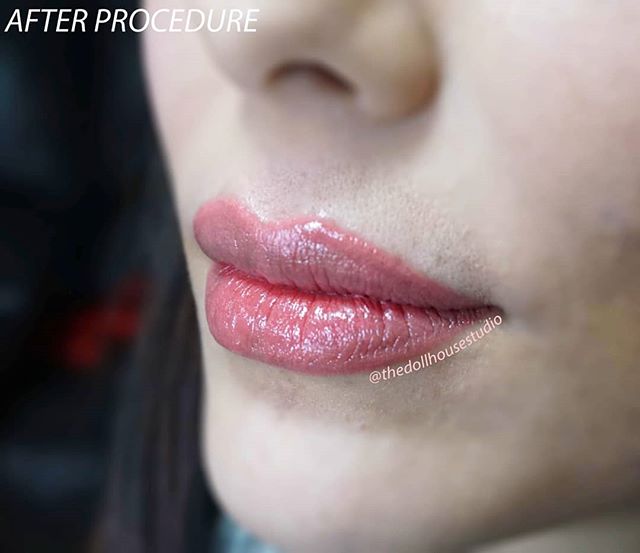 Lip Blush
Bringing a little life to these lips, uneven tones to pigmented lips.
&bull;
&bull;
&bull;
#lipblushing#pmu#permanentmakeup#lipcolor#liptattoo#thedollhousestudio
