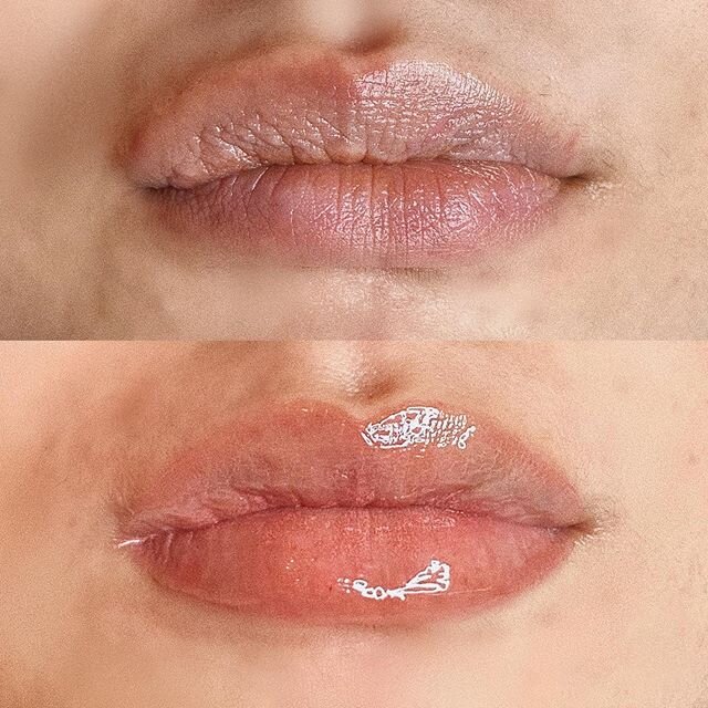 Send nudes 😆🤪 just kidding haha!
This client wanted a very natural nude color. When this heals, it will become a natural tint. 
We also color corrected some darkness that was on the top of her lip, as well as the symmetry and shape! 💗💓 P.s. Happy