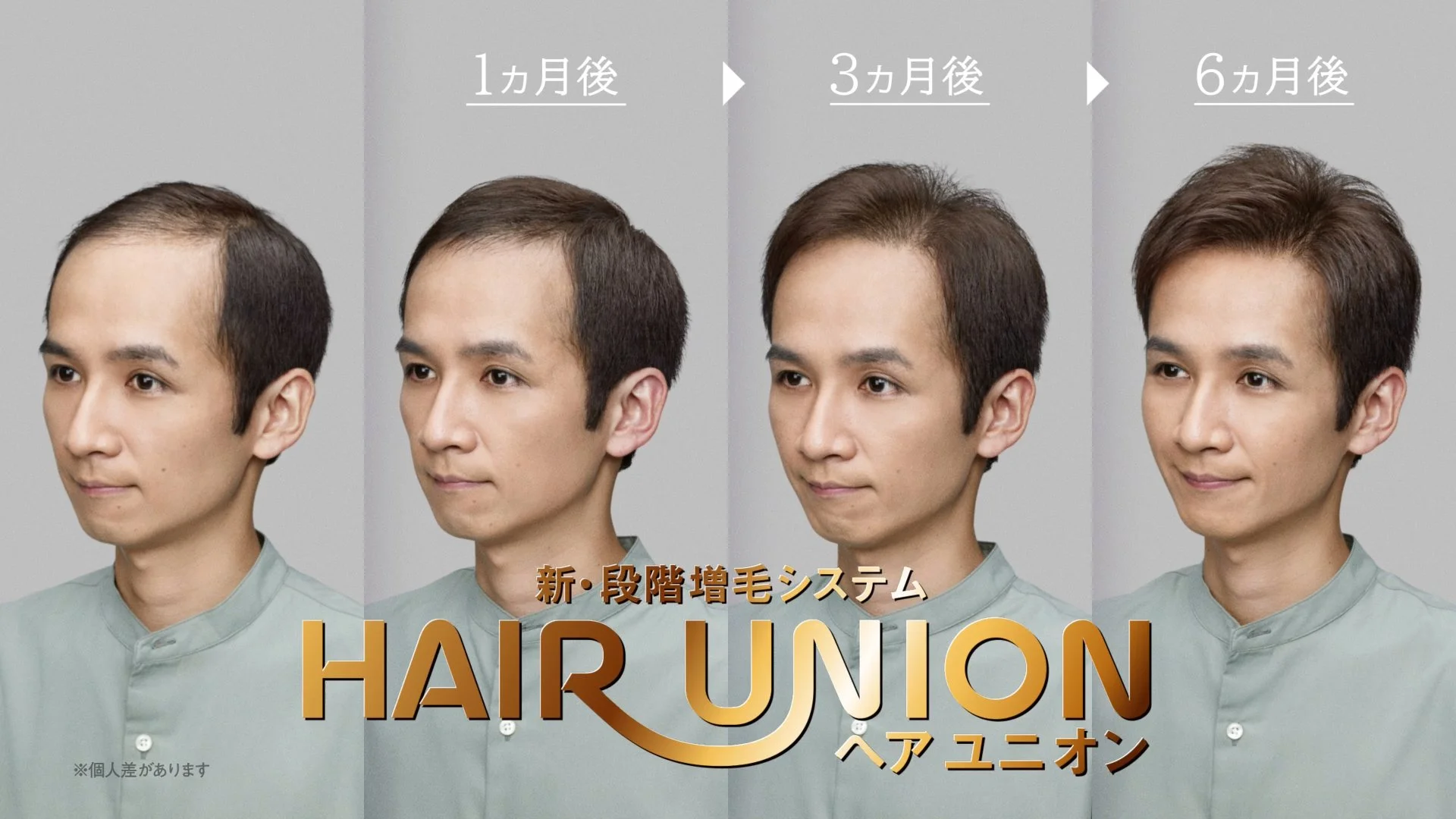 【薄毛対策】HAIR UNION 〇ヵ月後の自分篇 30秒【アートネイチャー】30s_TEL01-MP4.mp4.00_00_19_09.静止画012.jpg