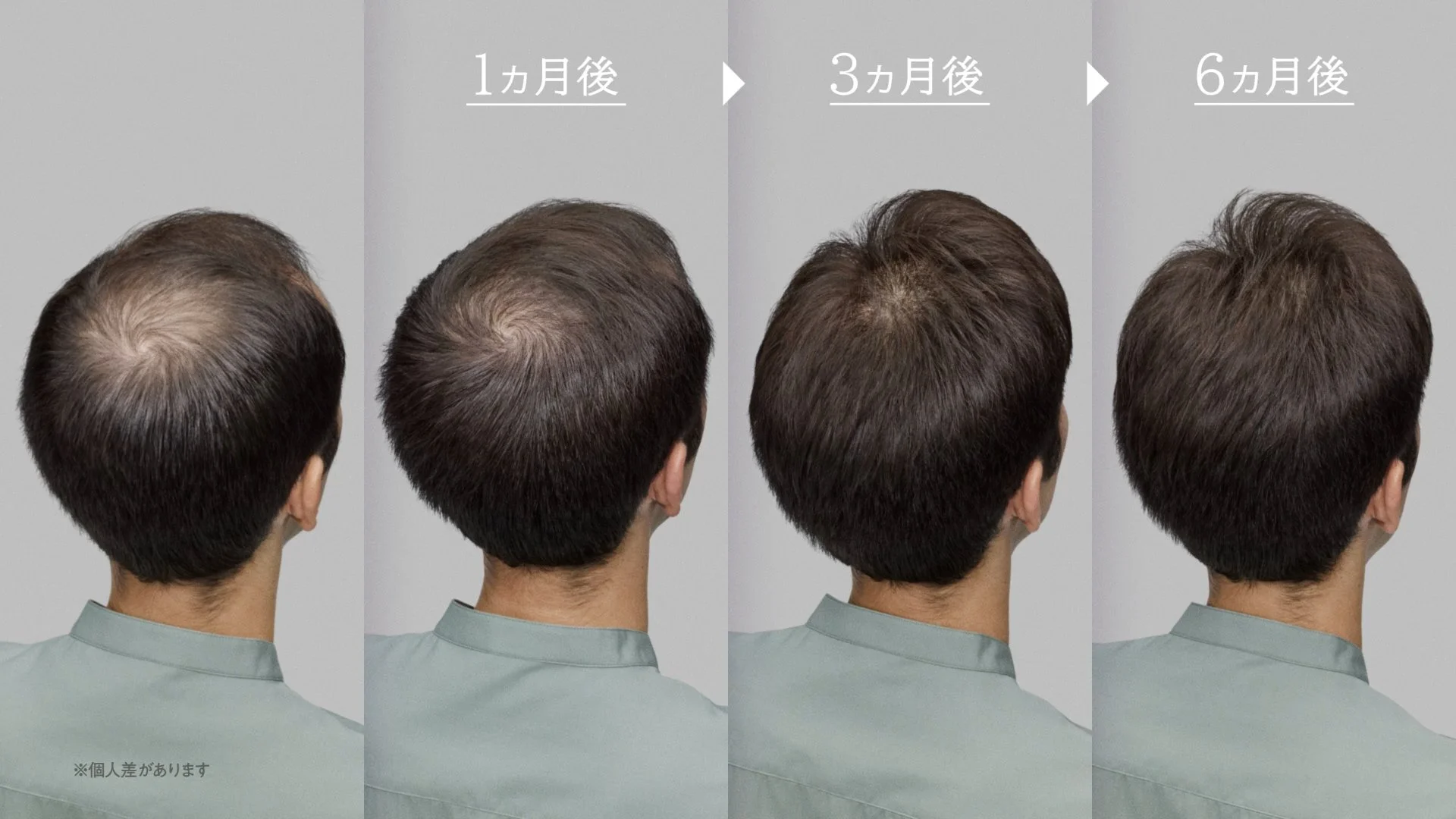 【薄毛対策】HAIR UNION 〇ヵ月後の自分篇 30秒【アートネイチャー】30s_TEL01-MP4.mp4.00_00_16_18.静止画011.jpg