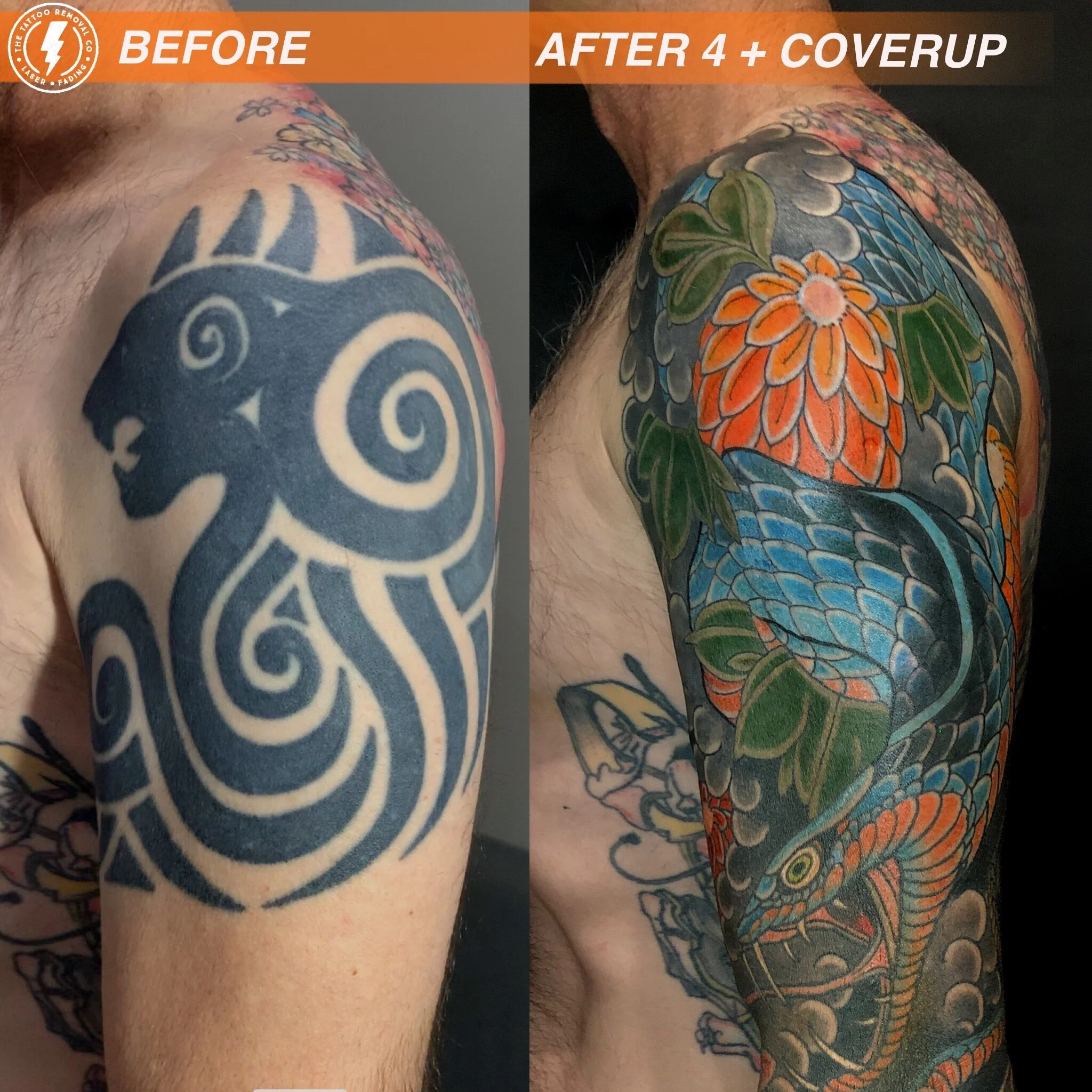 laser+tattoo+removal+Adelaide+melbourne+results+9.JPG