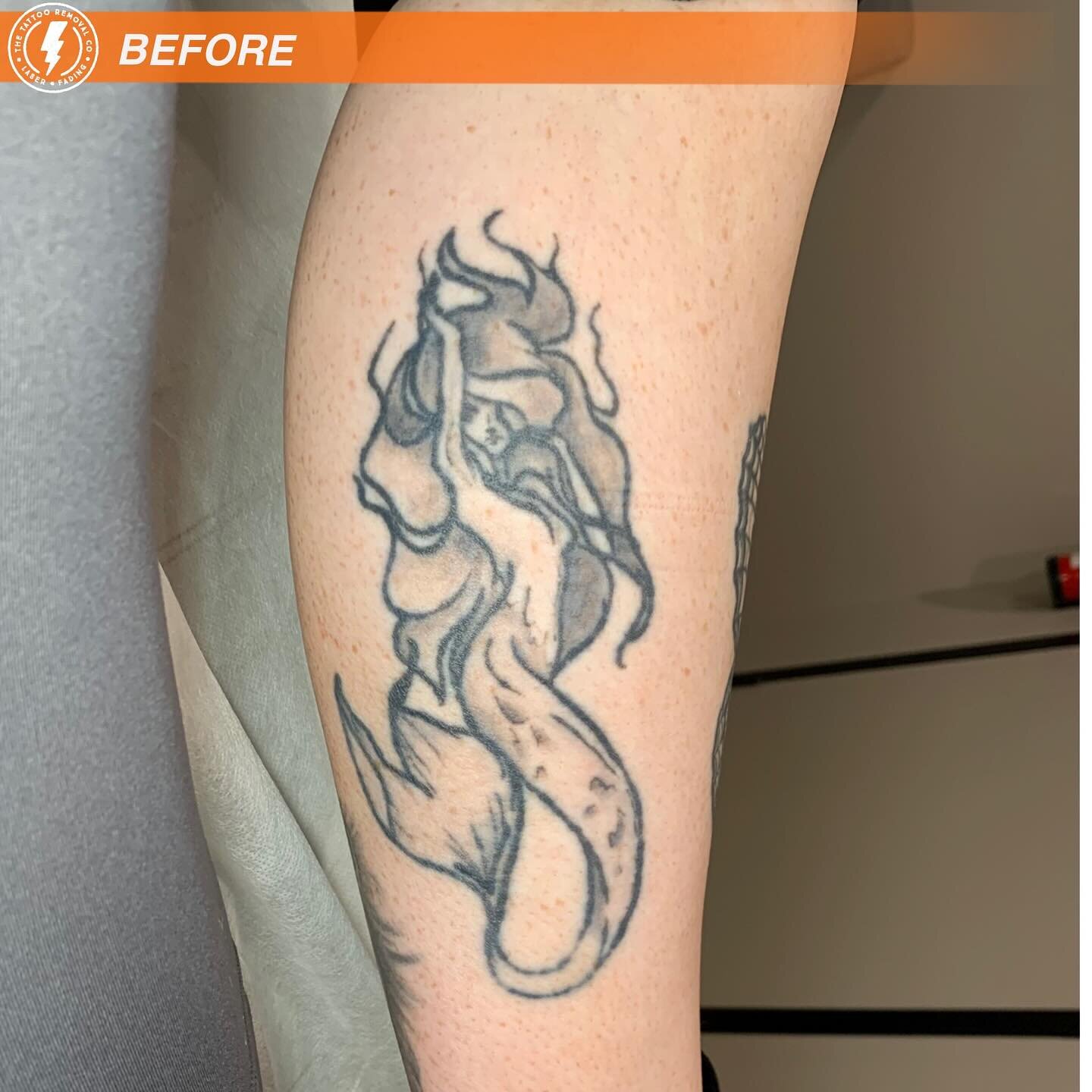 BEFORE/AFTER 4 TREATMENTS/COVERUP💥

⚡️SWIPE =======================&gt;⚡️

Amazing coverup on this lower leg piece.

⚡️Fabulous result and amazing coverup. These are the results you get with our experienced and knowledgeable Laser Technician @philly