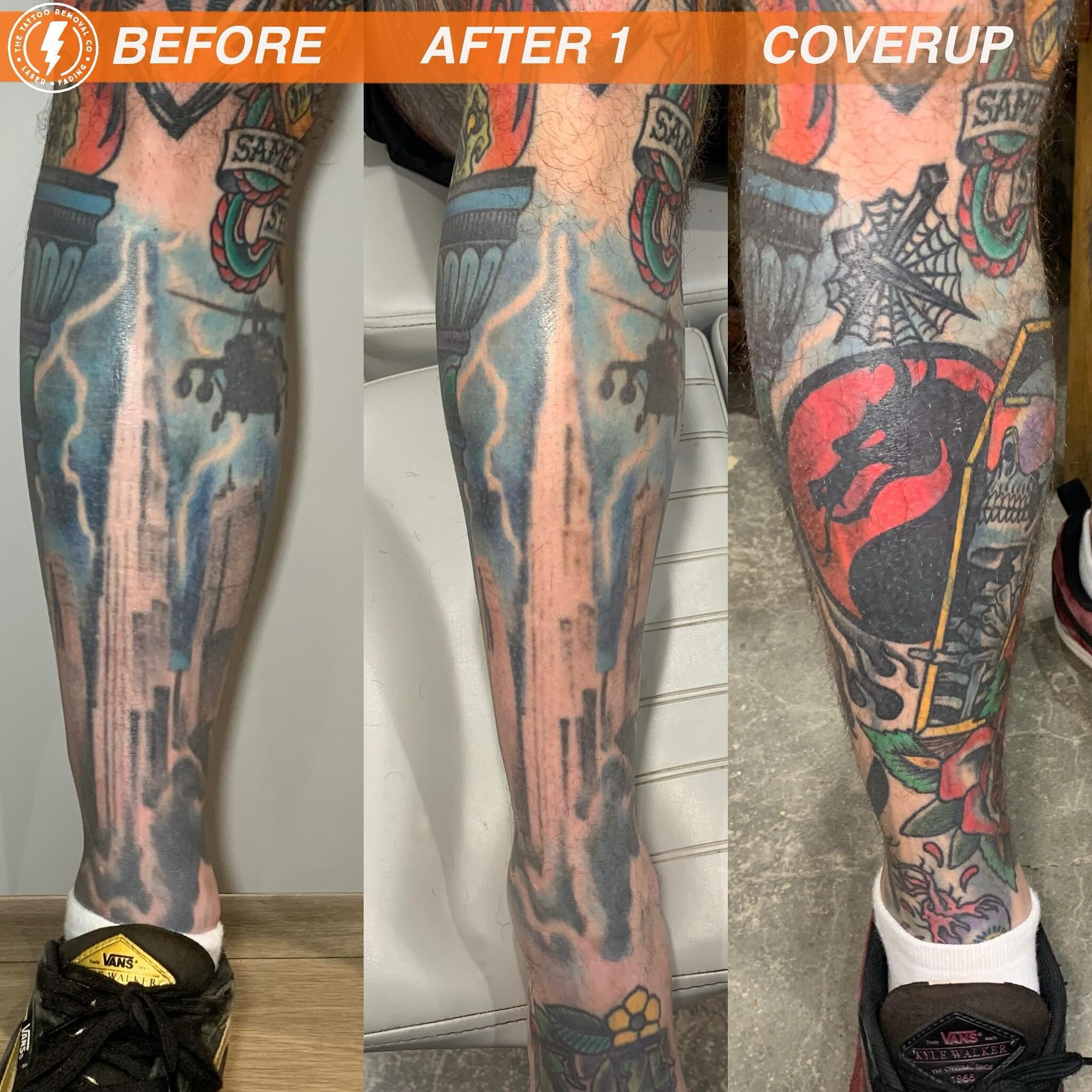 BEFORE/AFTER 1 TREATMENT💥
 
Amazing coverup @jamieangustattoo 

Sometimes you can use the original tattoo to aid with the new design.

⚡️Fabulous result so far. These are the results you get with our experienced and knowledgeable Laser Technician @p