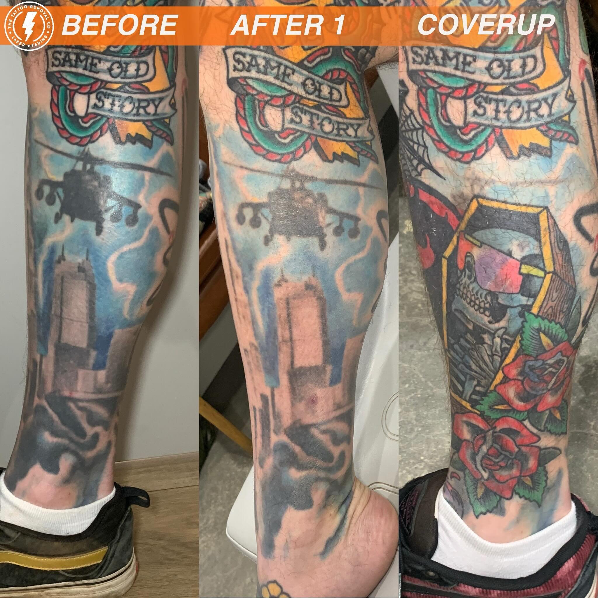 BEFORE/AFTER 1 TREATMENT/COVERUP💥

Get to the Choppa 🚁

Amazing coverup @jamieangustattoo 

Sometimes with coverups you can actually use the original tattoo to help with creating new tattoos. This piece the blue was still used as the backdrop.

⚡️F