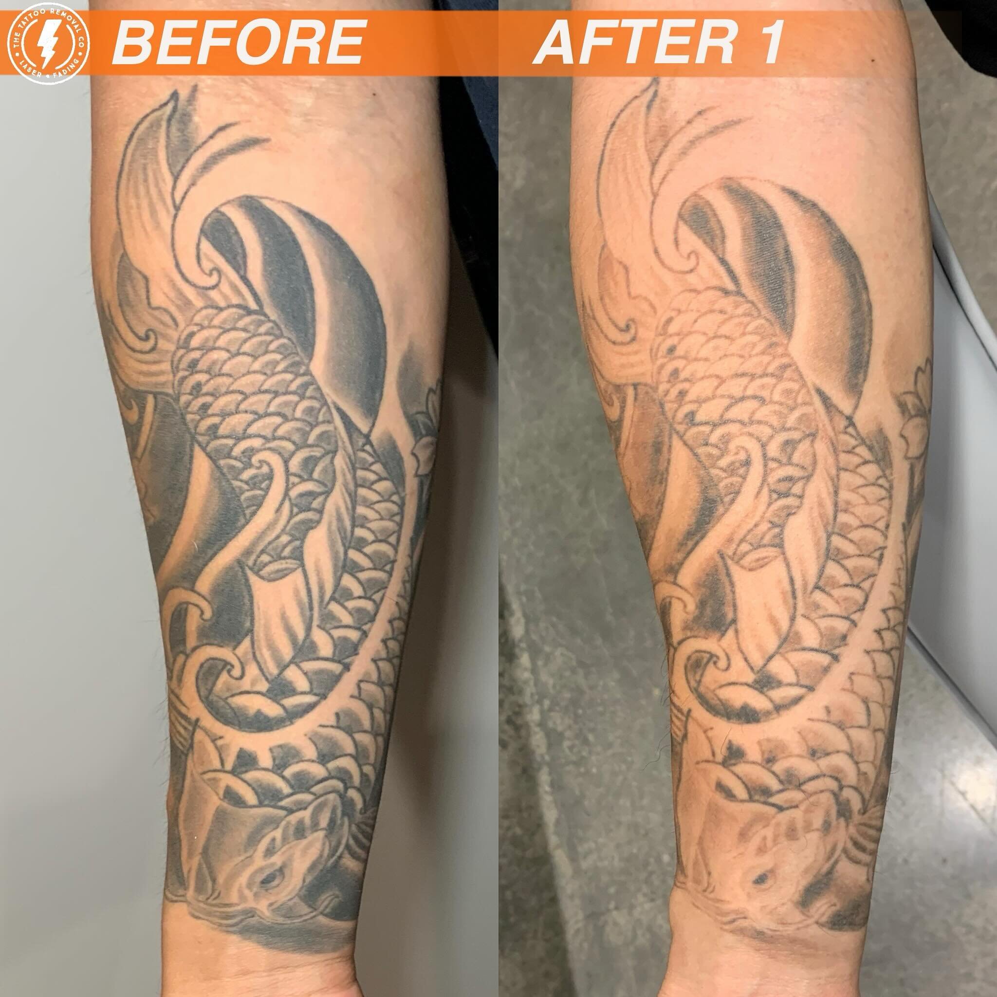BEFORE/AFTER 1 TREATMENT💥

Ohhhh the shading got smashed!

⚡️Fabulous result so far. These are the results you get with our experienced and knowledgeable Laser Technician @philly_ttrc_pagdin ⚡️

Consultations are FREE please don&rsquo;t hesitate to 