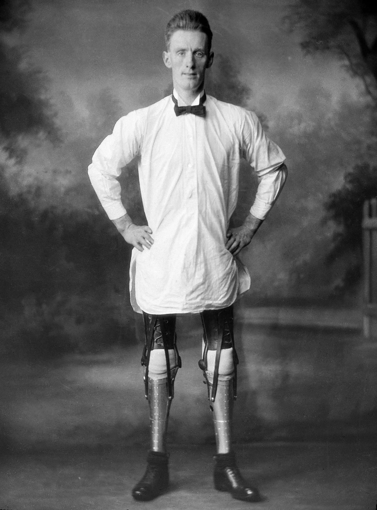 Images from the archive show this man with and without his prosthetic legs, and making legs in the workshop.
