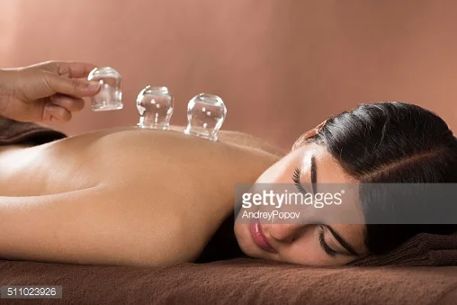 Cupping Bayonne & Jersey City Cupping