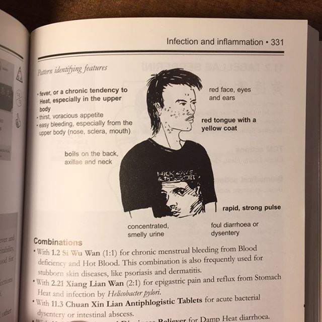 When you are flipping through a patent medicines book and notice the patient has a Nick Cave and the Bad Seeds t-shirt on 😂...he also has toxic damp heat in all three jiaos. #herbalmedicine #acujokes