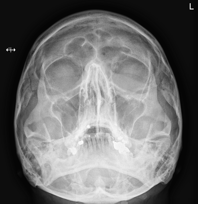 SKULL Radiograph We have lots of other images that you may not see very often too - like OPGs, nuclear medicine and barium studies