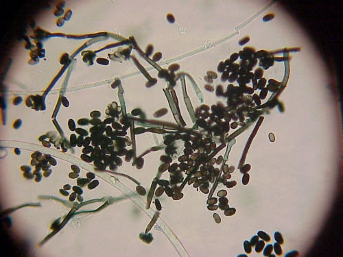 Stachybotrys, a "black mold" spore indicative of water damage