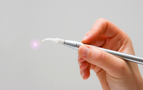 soft-tissue-laser-2.png