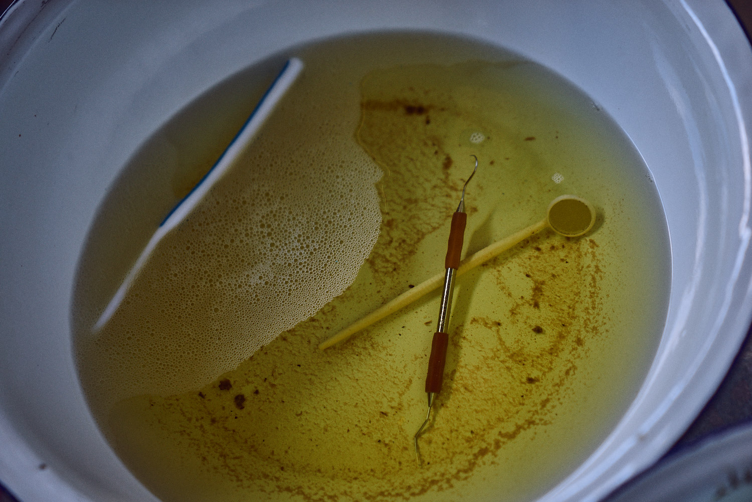 A sterilization solution for used instruments.