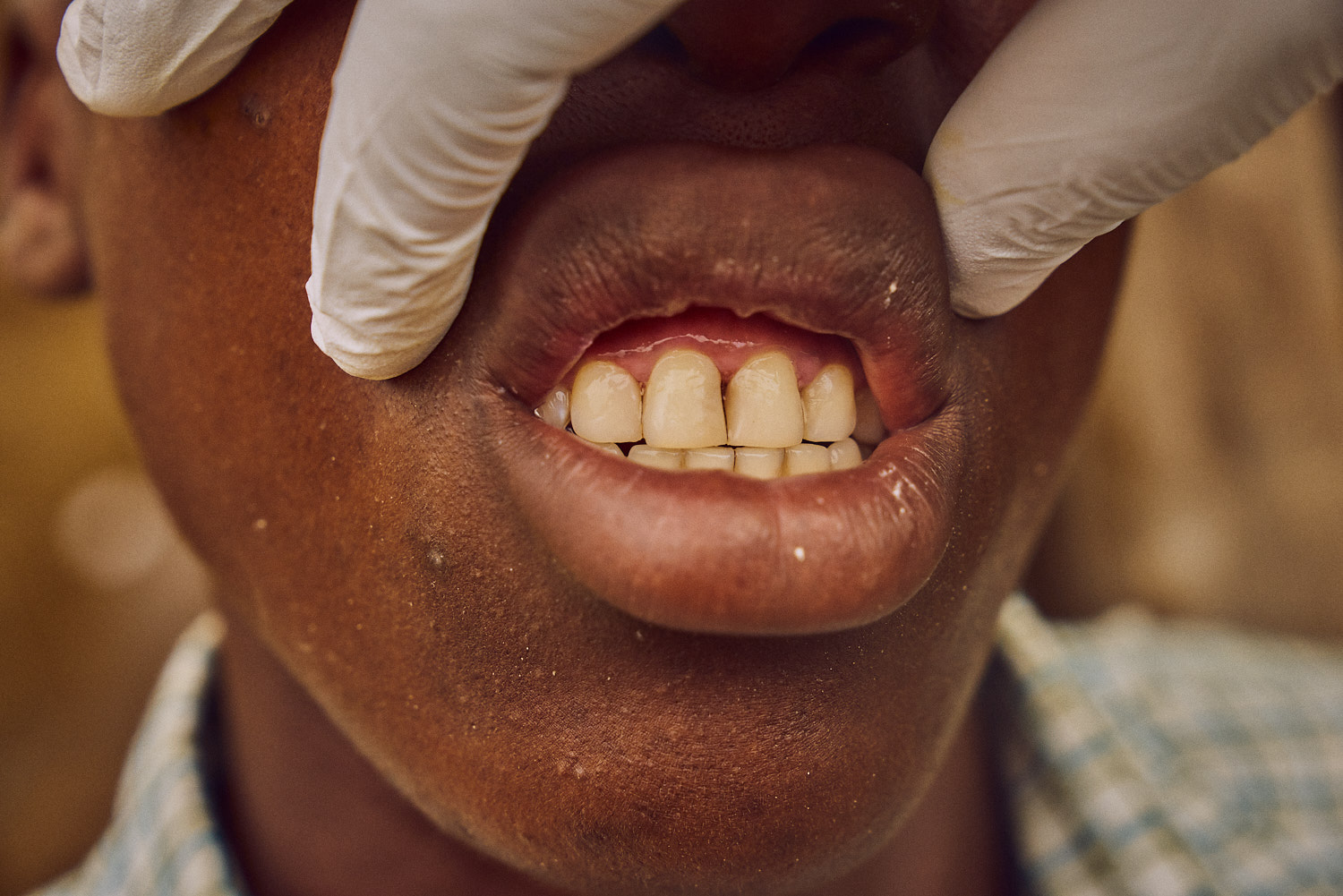 The completed dental work.