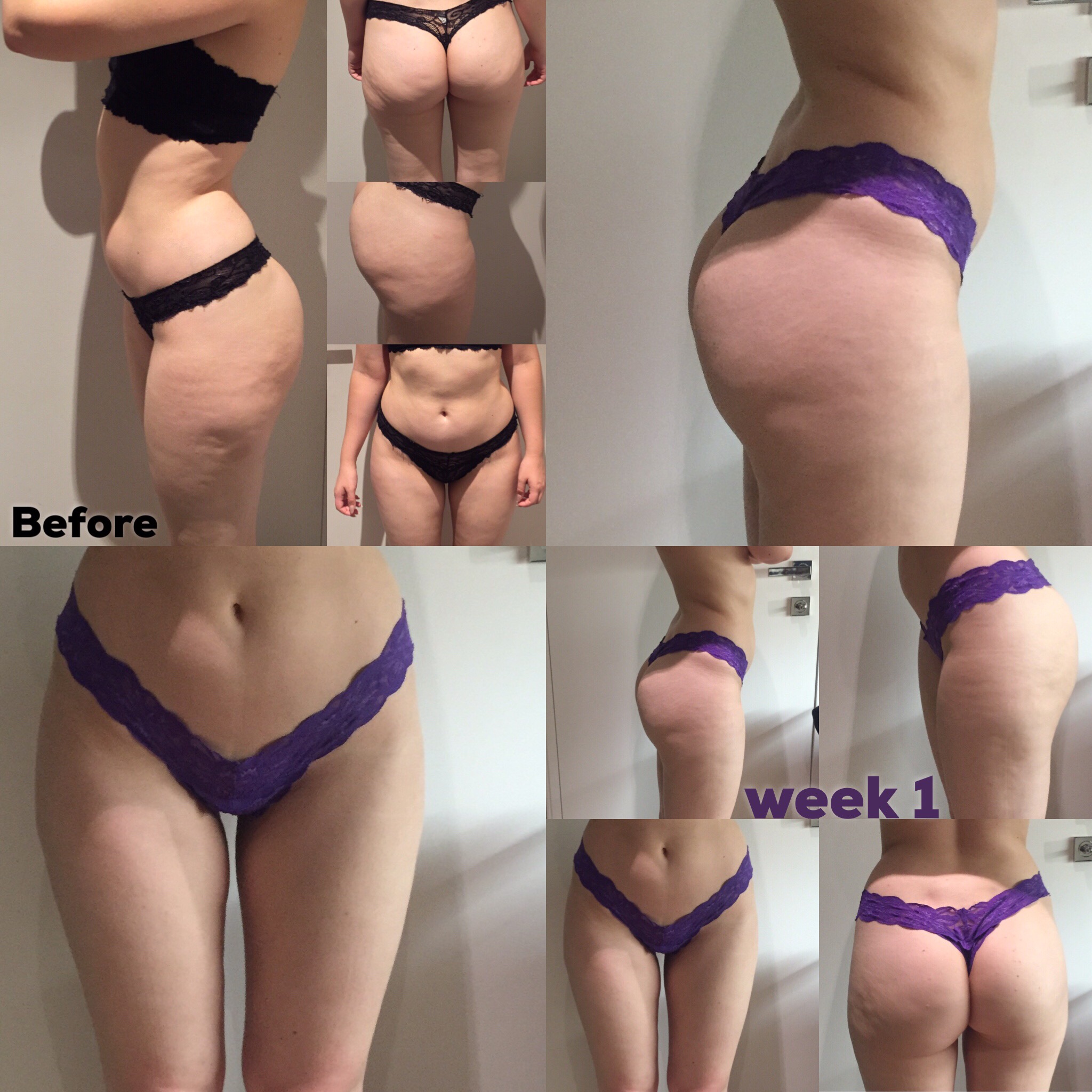 After 4 Hypoxi sessions and keeping to my strict carb free diet. 