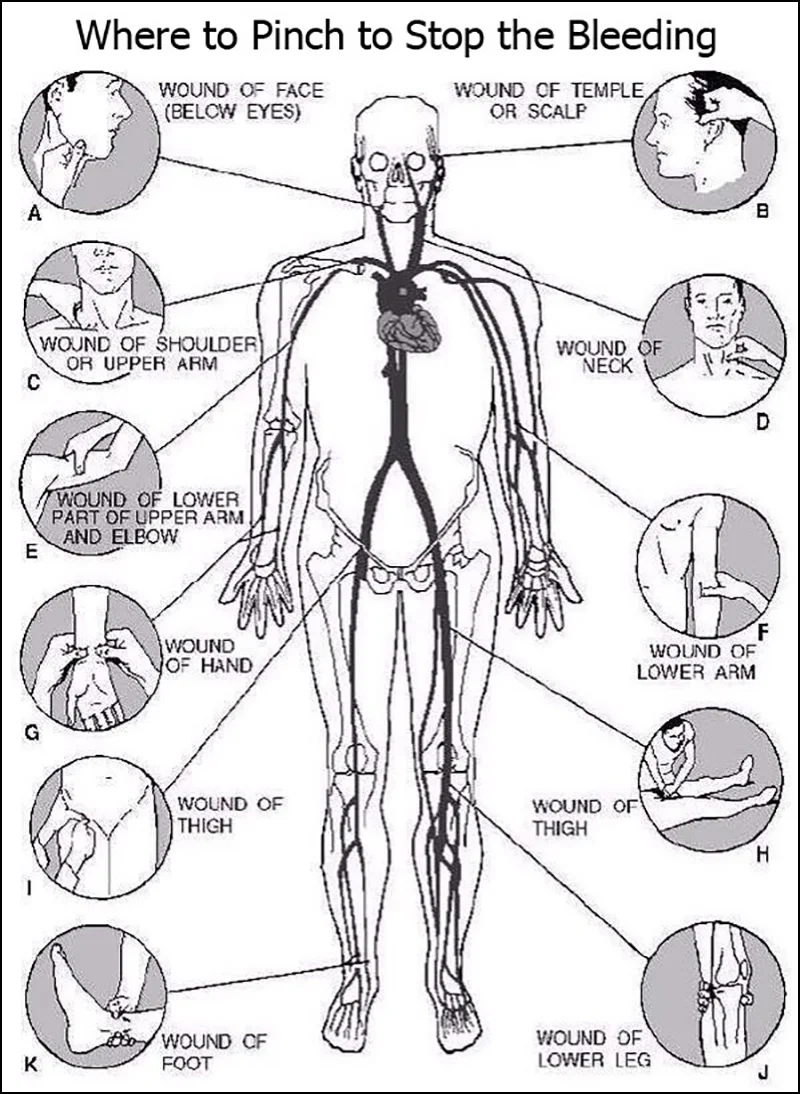 00051_STOP-BLEEDING.jpg