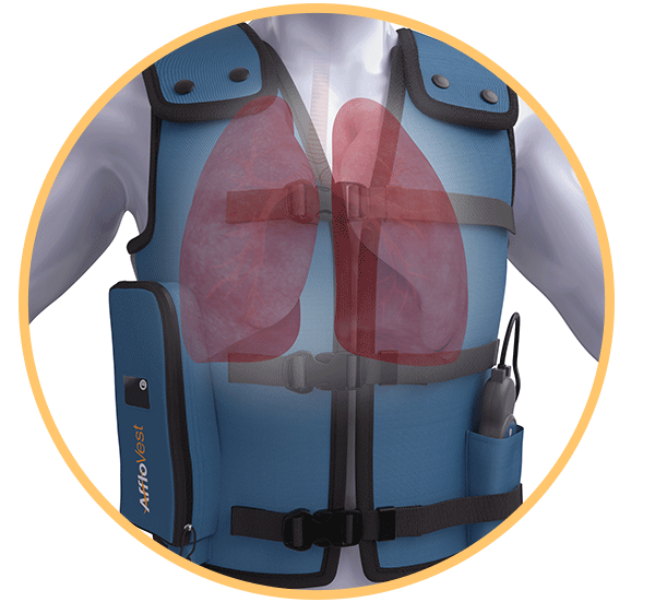 Afflovest — Trace Medical