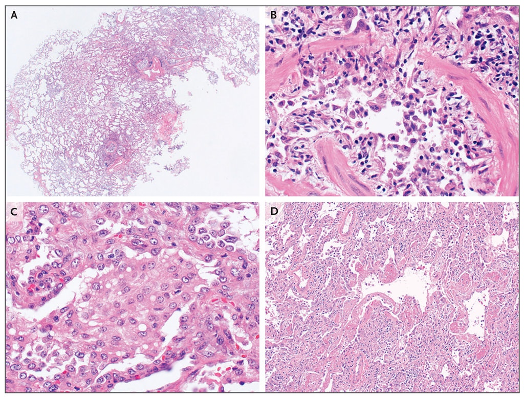The Finale of Teens’ Lives In the United States