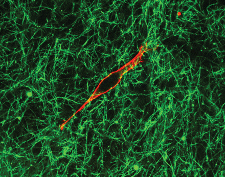 A cell (red) within the sponge of the extracellular matrix (green). Image credit to Nicholas O. Deakin of SUNY Upstate Medical University .