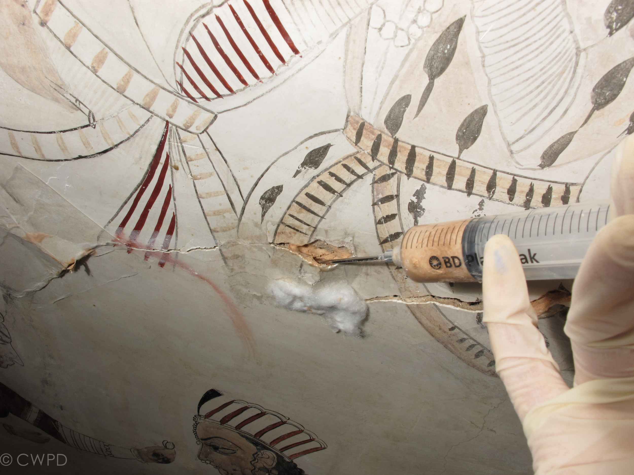  Pipettes, syringes, needles and catheters were used as required to inject the custom grout, stabilizing areas of detached plaster.  Image © Courtauld CWPD 