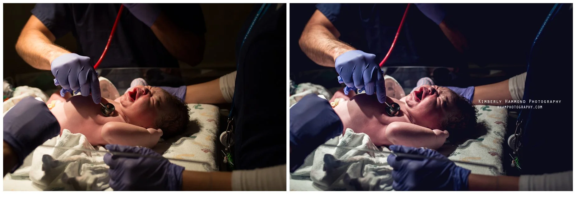 Newborn is check out by doctors shortly after birth at Baylor Medical Center in Dallas, TX.