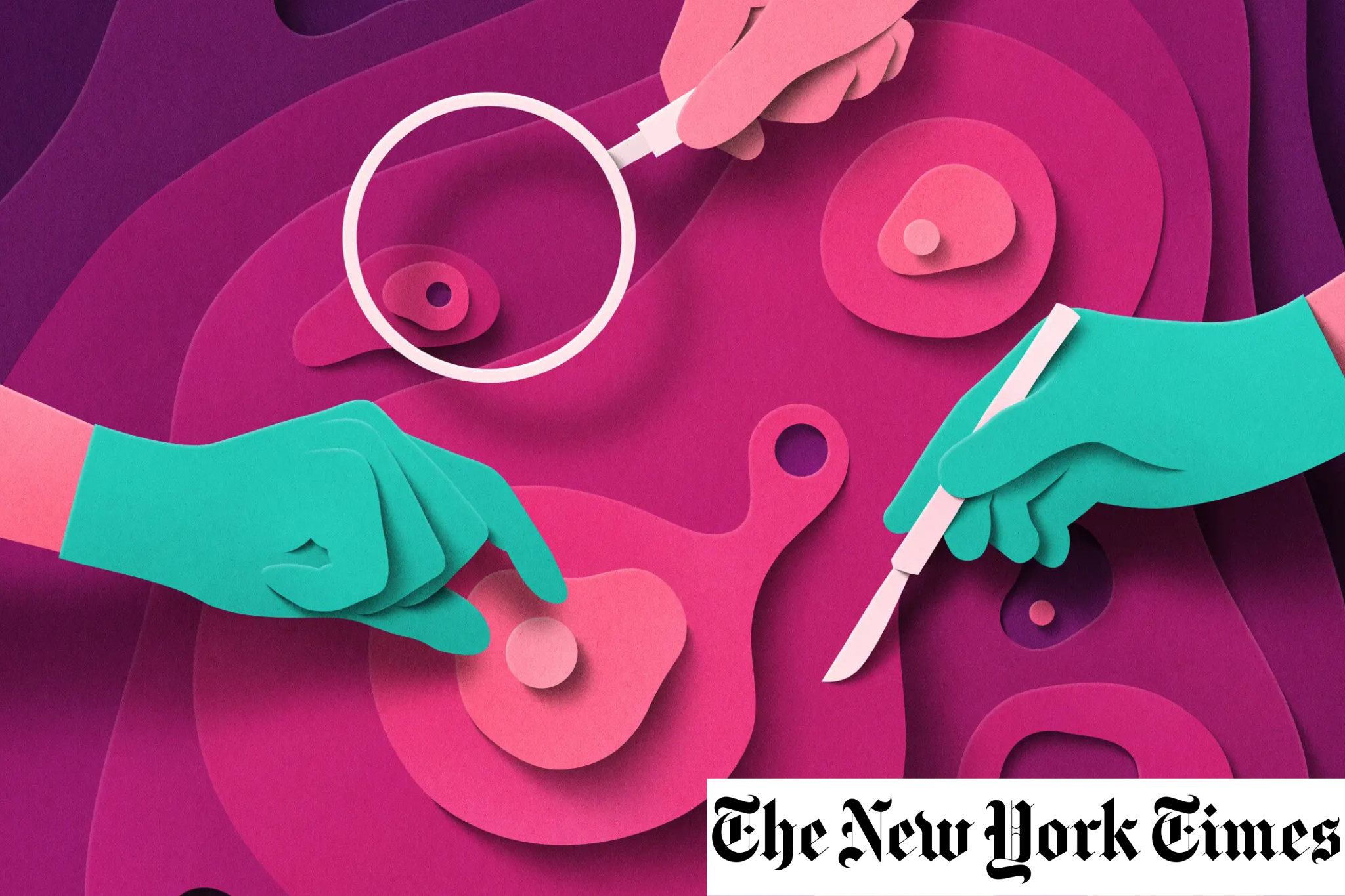 To Treat Prostate Cancer, There Are More Options Than Ever