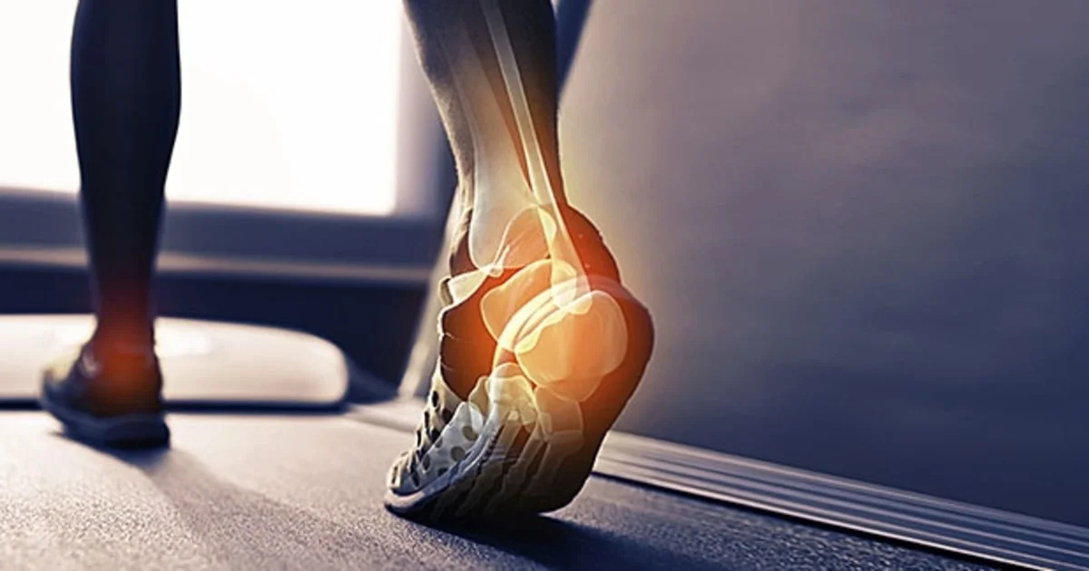 mj-618_348_the-real-reason-you-have-plantar-fasciitis-and-how-to-fix-it.jpg