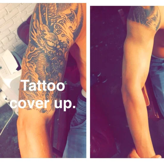 Tattoo cover up.