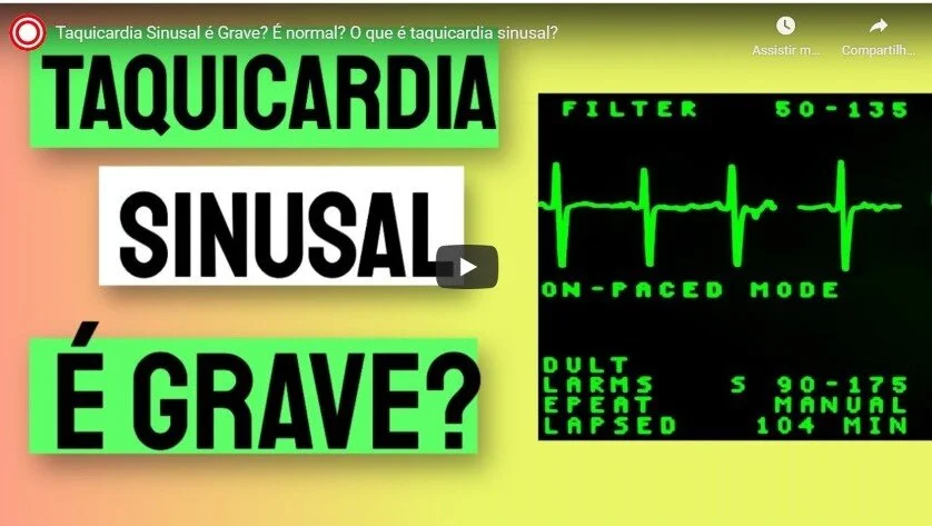 Taquicardia Sinusal é Grave? É normal? O que é taquicardia sinusal?