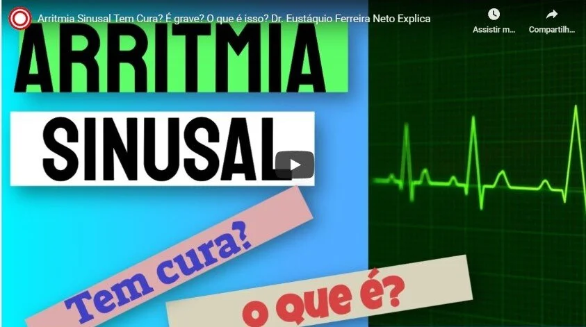 Arritmia Sinusal Tem Cura? É grave? O que é isso?