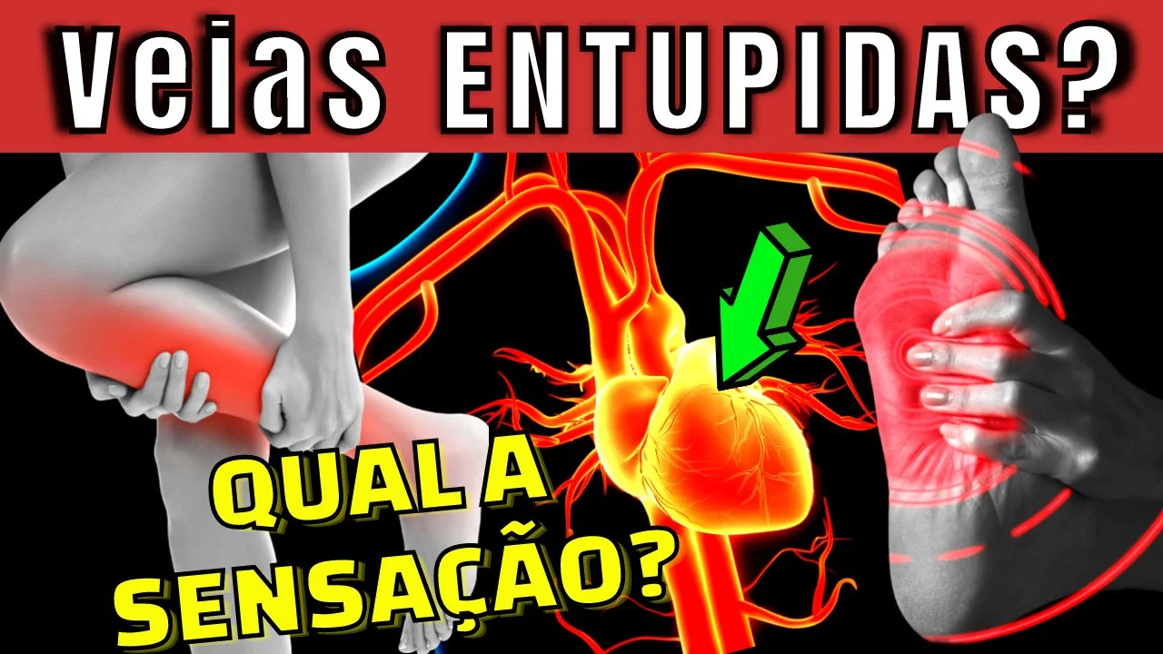 VEIA ENTUPIDA, QUAL A SENSAÇÃO? Como combater a falta de circulação nas pernas, pés e coração