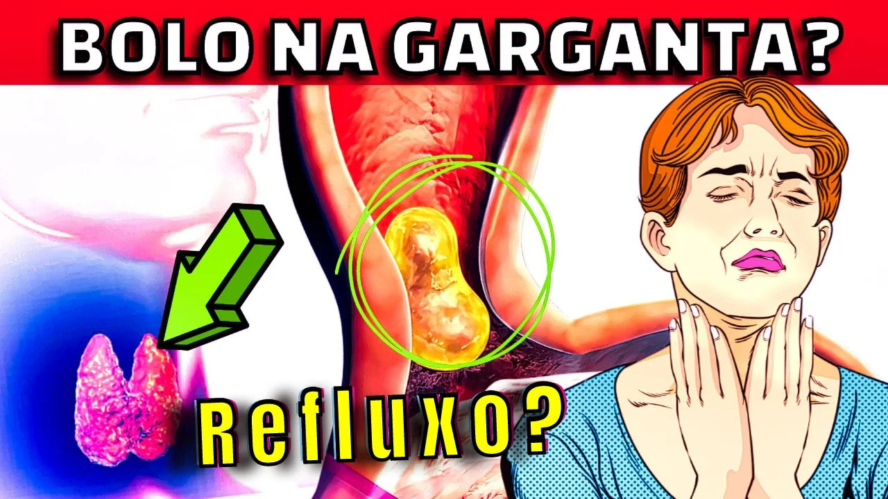 Sensação de BOLO PRESO NA GARGANTA? PIGARRO e TOSSE? Pode ser REFLUXO? Quais as causas e tratamento?