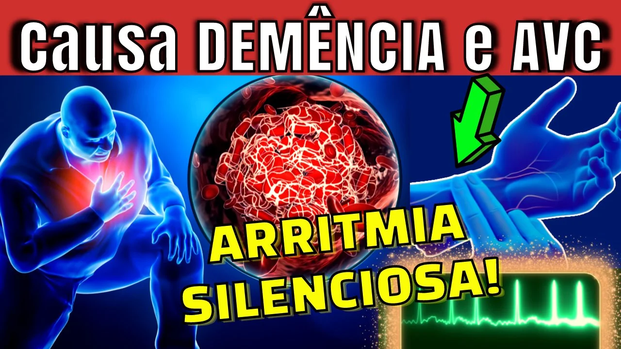 5 SINAIS de FIBRILAÇÃO ATRIAL- A ARRITMIA CARDÍACA SILENCIOSA MUITO IGNORADA  QUE CAUSA DEMÊNCIA, DERRAME e CORAÇÃO FRACO