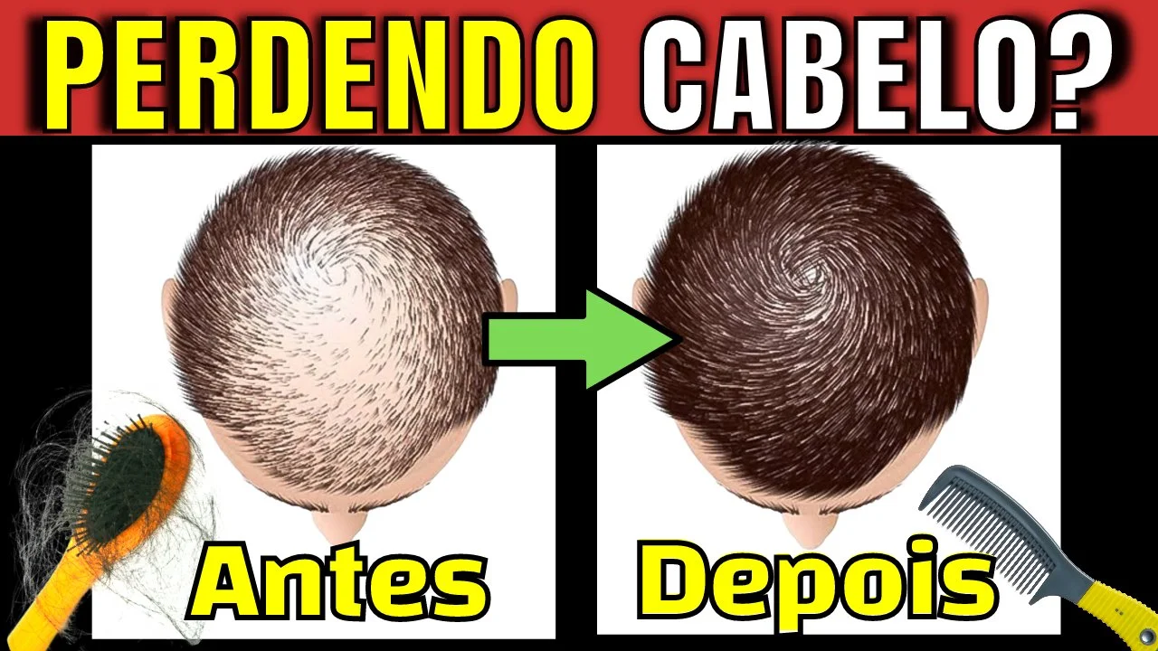 5 TRATAMENTOS PROVADOS CONTRA QUEDA DE CABELO| Remédios, Xampus e Vitaminas que FAZEM CRESCER CABELO