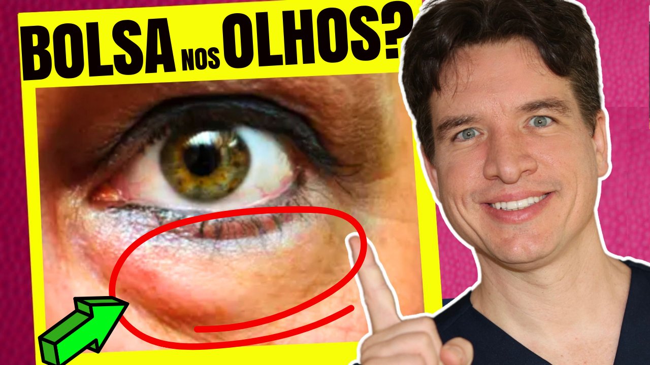 COMO ELIMINAR O INCHAÇO NAS PÁLPEBRAS! 5 Dicas Naturais que REALMENTE Funcionam! 