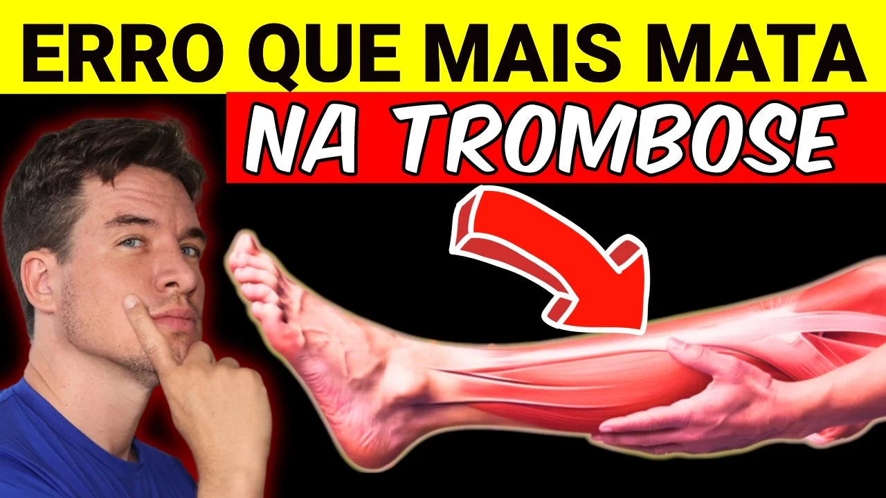 NÃO MORRA de TROMBOSE! | 7 MANEIRAS PROVADAS de MELHORAR a CIRCULAÇÃO e PREVENIR TROMBOSE NAS PERNAS