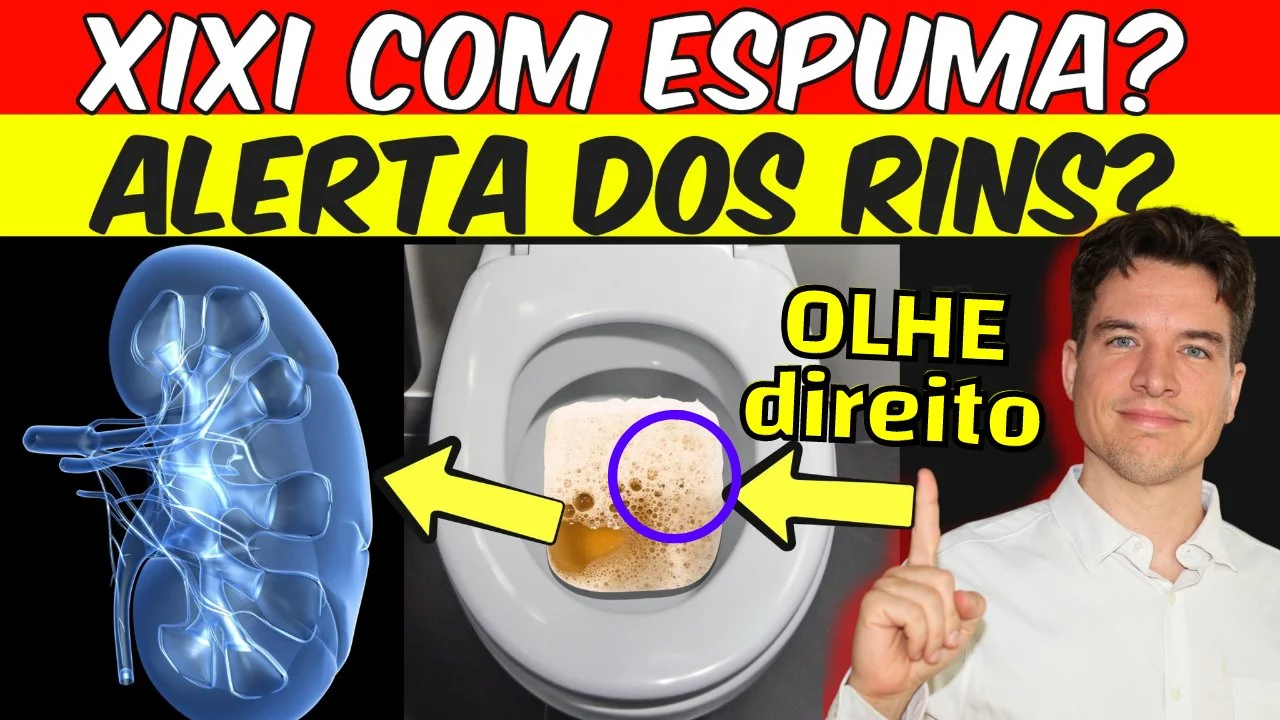Urina ESPUMANDO MUITO? O que significa? Como Tratar? (proteinúria)