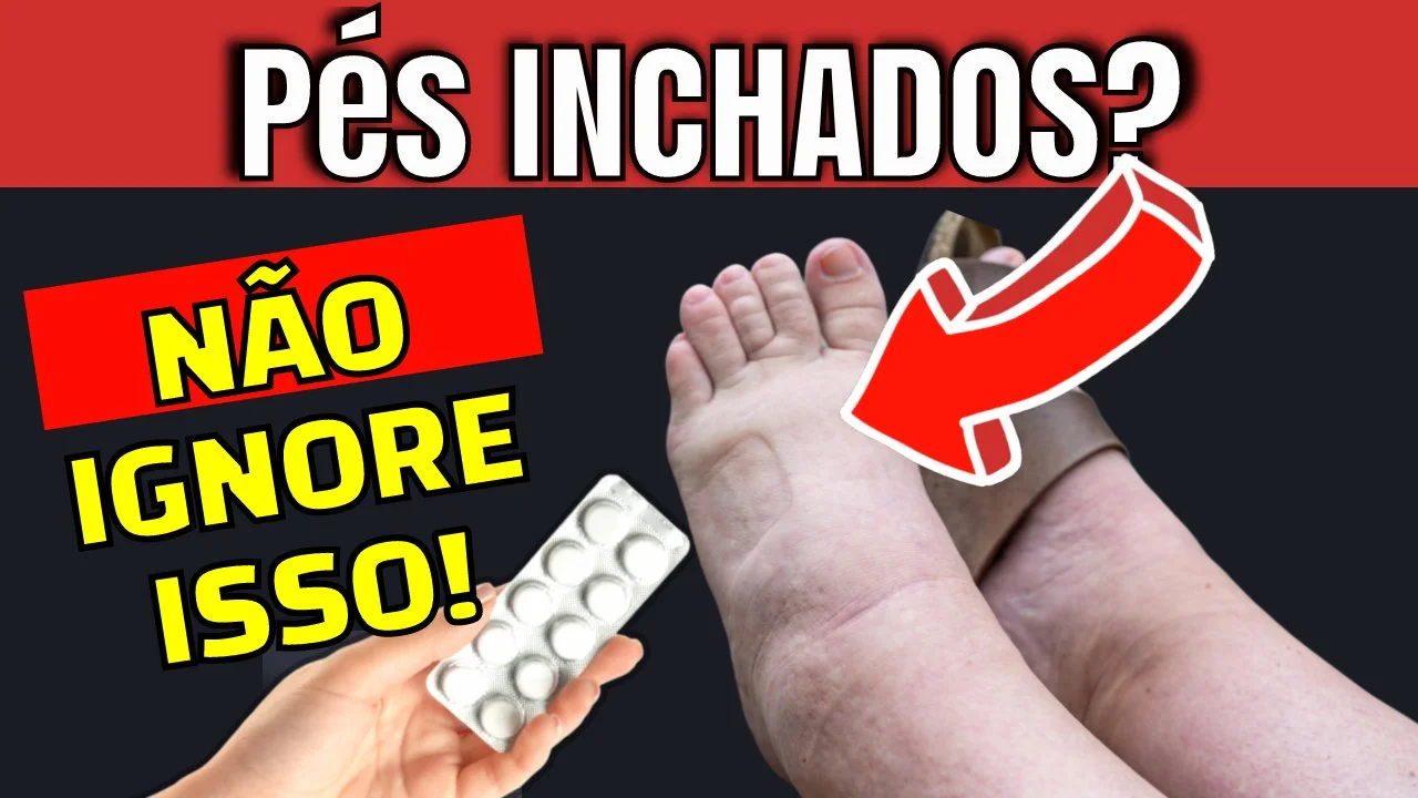 Pernas Inchadas? O Erro FATAL Que Você Está Cometendo (e Como Corrigir AGORA!)