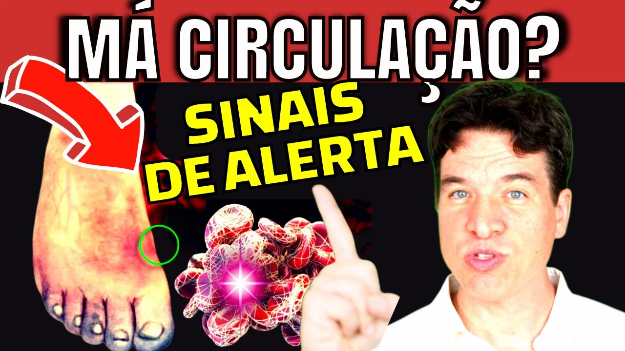 Sintomas PERIGOSOS de MÁ CIRCULAÇÃO nas PERNAS (como melhorar sua ...