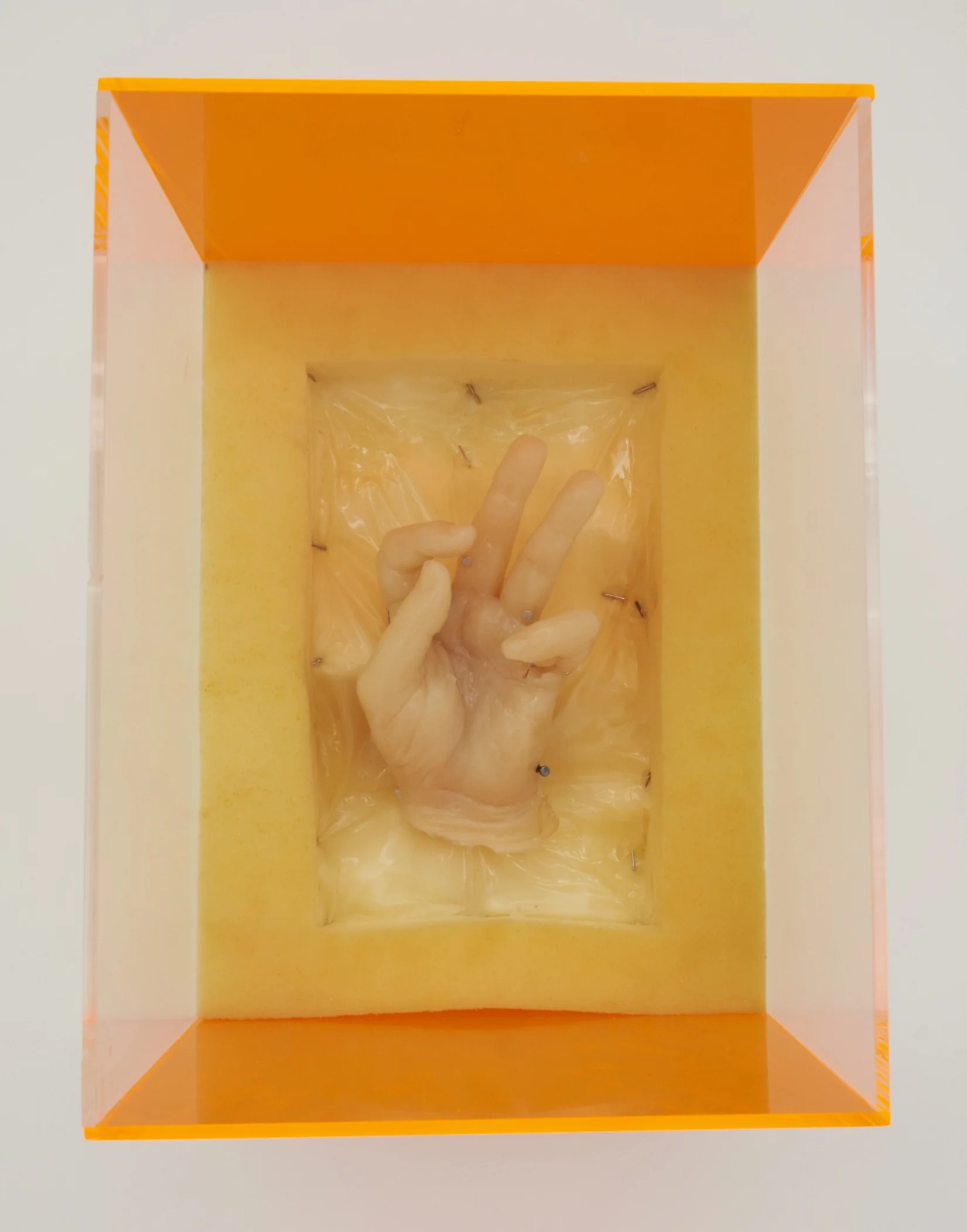 Whitney Vangrin, Dupuytren's Contracture, 2013 The Pleasure Principle , 2016, installation view