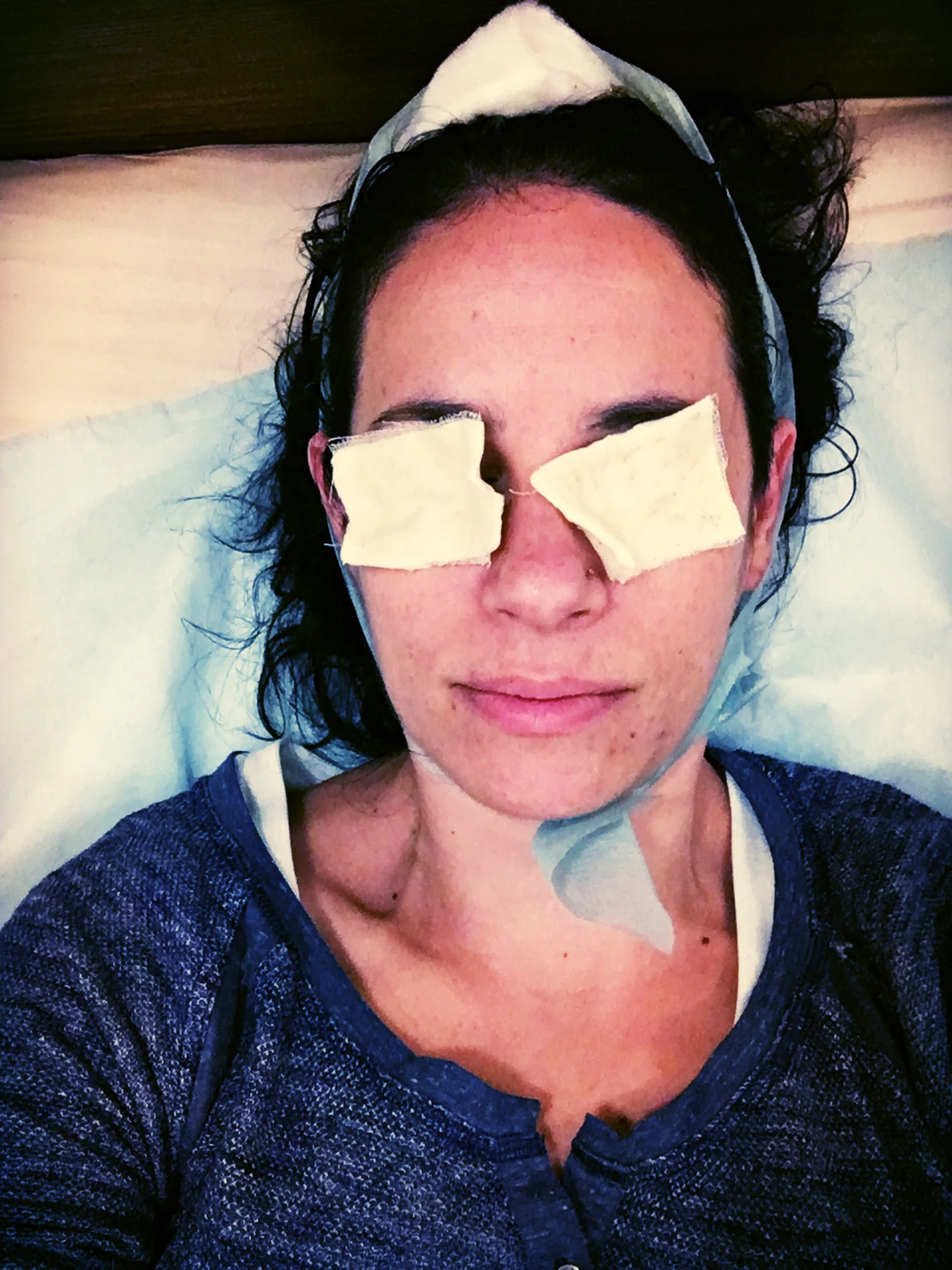 Nighttime treatment selfie.